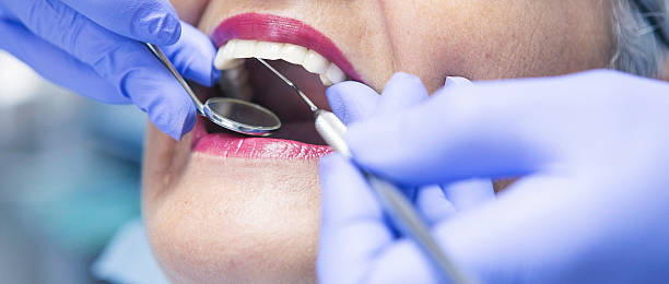 Best Emergency Wisdom Teeth Removal in Jenks, OK