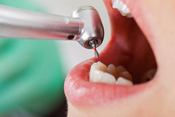 Best Emergency Treatment for Toothache in Jenks, OK